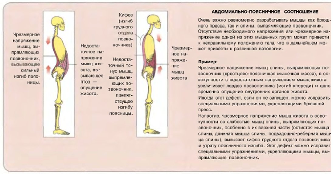 Мышцы осанки. Мышцы спины при осанке. Гипертонус мышц поясницы. Пояснично-подвздошная мышца и осанка. Осанка подвздошные мышцы.